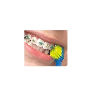 Зубна щітка ортодонтична Curaprox CS 5460 Ultra SOFT Ortho